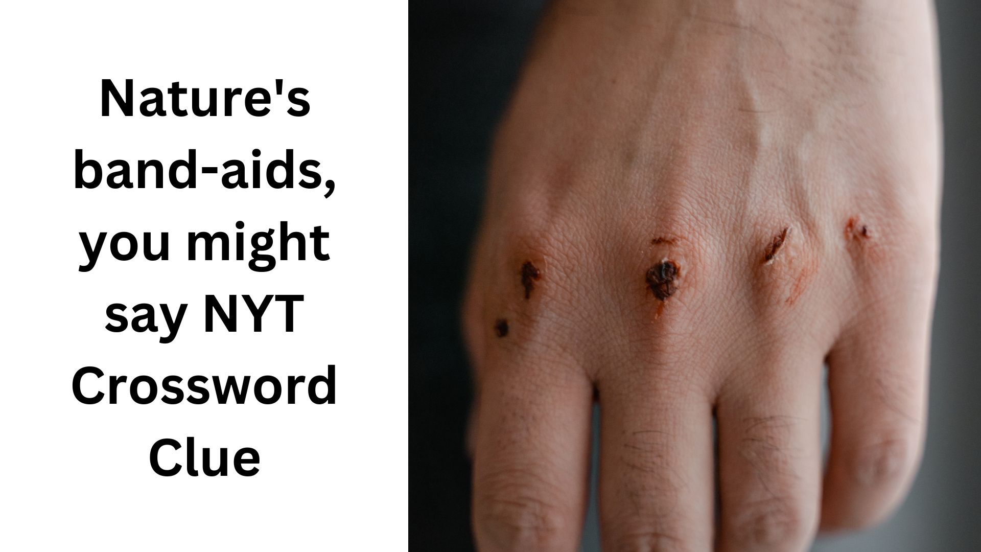 Nature's band-aids, you might say NYT Crossword Clue